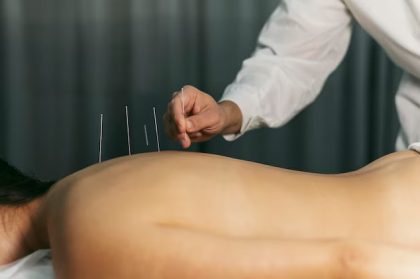Acupuncture Course in Chennai for Career Boost