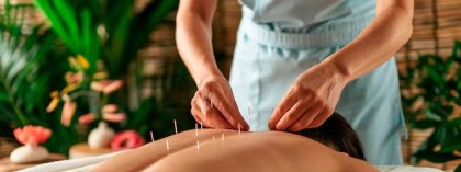 dry needling in chennai