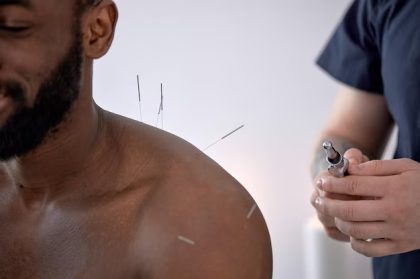 traditional chinese medicine acupuncture in chennai
